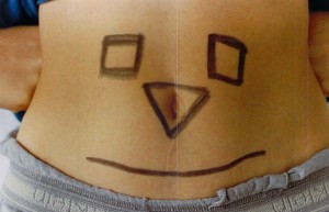 They marked my abdomen to aim the radiation treatment.  I imagine my brave face over the scar the surgery left.